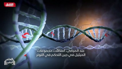 ...سؤال هي بواسطة الروبوتات . وقد لاحظ البا...