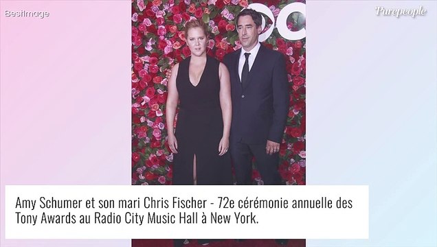 Amy Schumer défigurée par la chirurgie, elle est obligée de faire dissoudre le produit injecté !