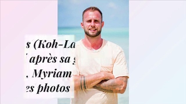 Thomas (Koh-Lanta) éprouvé après sa greffe capillaire, Myriam dévoile des photos