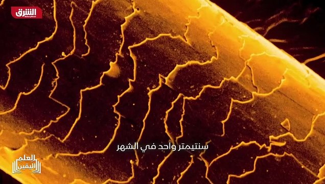 ...من حياة شعر جودت يعاني من التوتر ايضا ، ...