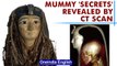 3500-year-old Egyptian mummy unwrapped after 140 years by CT scan | Oneindia News