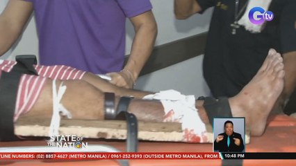 Mga ospital, nakahanda na para sa mga posibleng mabiktima ng paputok sa pagsalubong ng 2022 | SONA