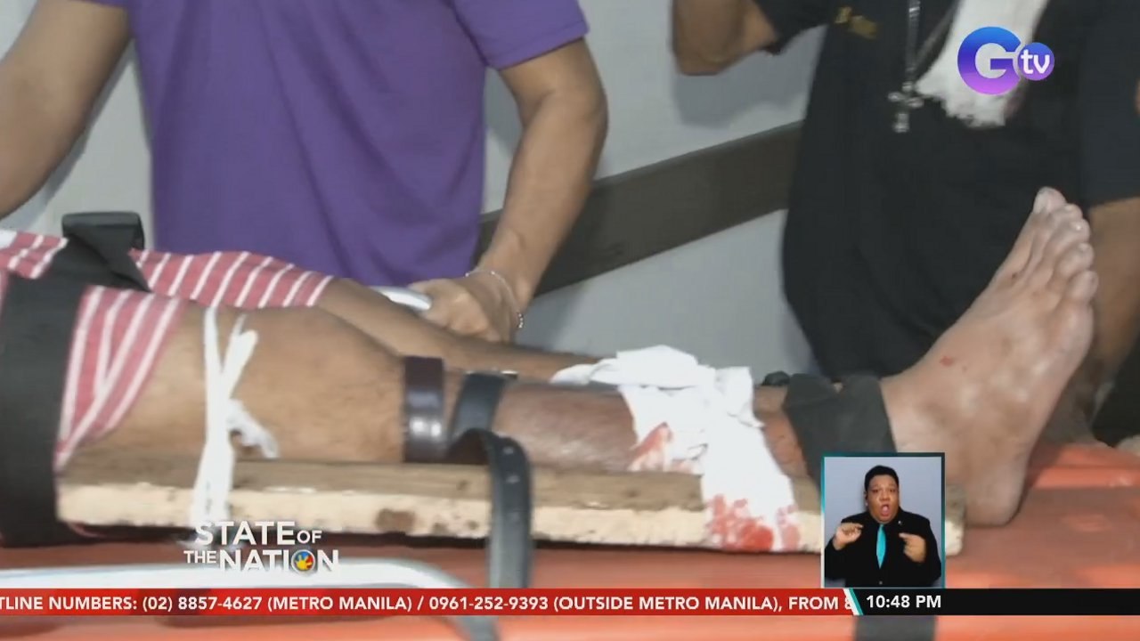 Mga ospital, nakahanda na para sa mga posibleng mabiktima ng paputok sa pagsalubong ng 2022 | SONA