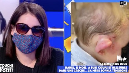 FEMME ACTUELLE - TPMP : le témoignage alarmant d'une mère qui retrouve son fils de 15 mois le visage tuméfié à la crèche