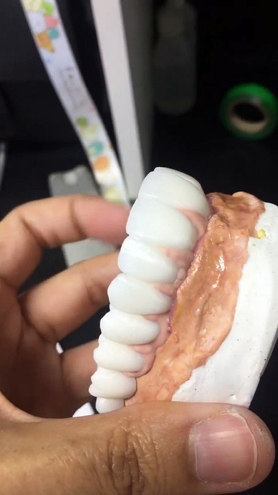Dental videos