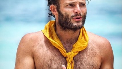 FEMME ACTUELLE - "Koh Lanta" : un ancien candidat s'affiche défiguré après une greffe de cheveux
