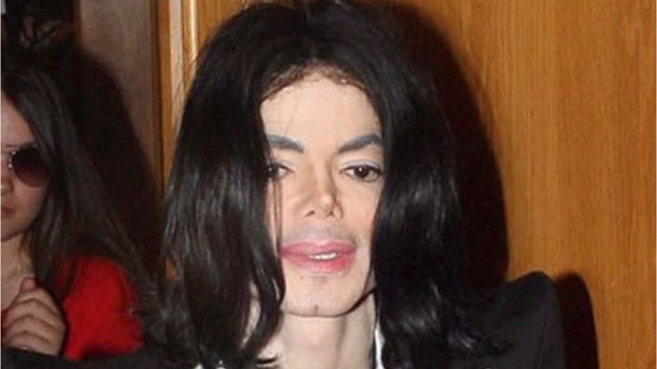 FEMME ACTULLE - Michael Jackson : les nouvelles révélations sur son nez abîmé par la chirurgie esthétique