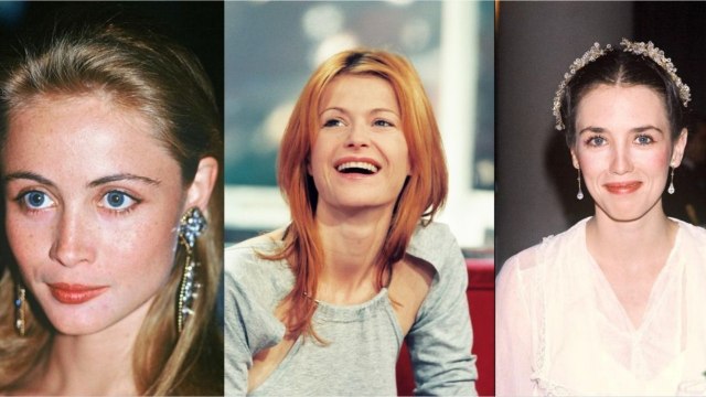 FEMME ACTUELLE - Avant/après, ces stars qui ont refait leurs lèvres