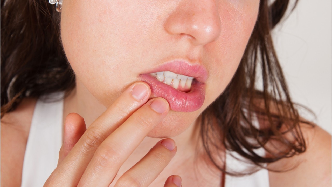 Herpes Labial Transmission A Bebe Risques Traitements Femme Actuelle Le Mag