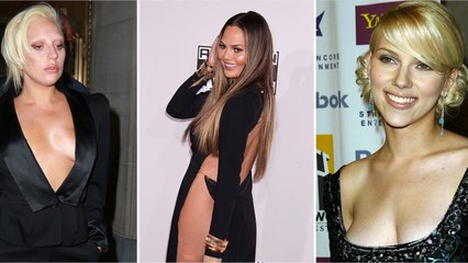 FEMME ACTUELLE - Ces stars qui assument leurs vergetures