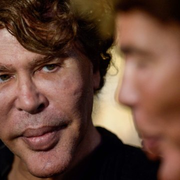 FEMME ACTUELLE - Igor et Grichka Bogdanoff ont-ils eu recours à la chirurgie esthétique ?