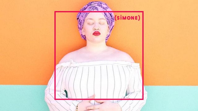 SIMONE : Joannè Dion, cette femme albinos qui a réussi à prendre sa revanche.