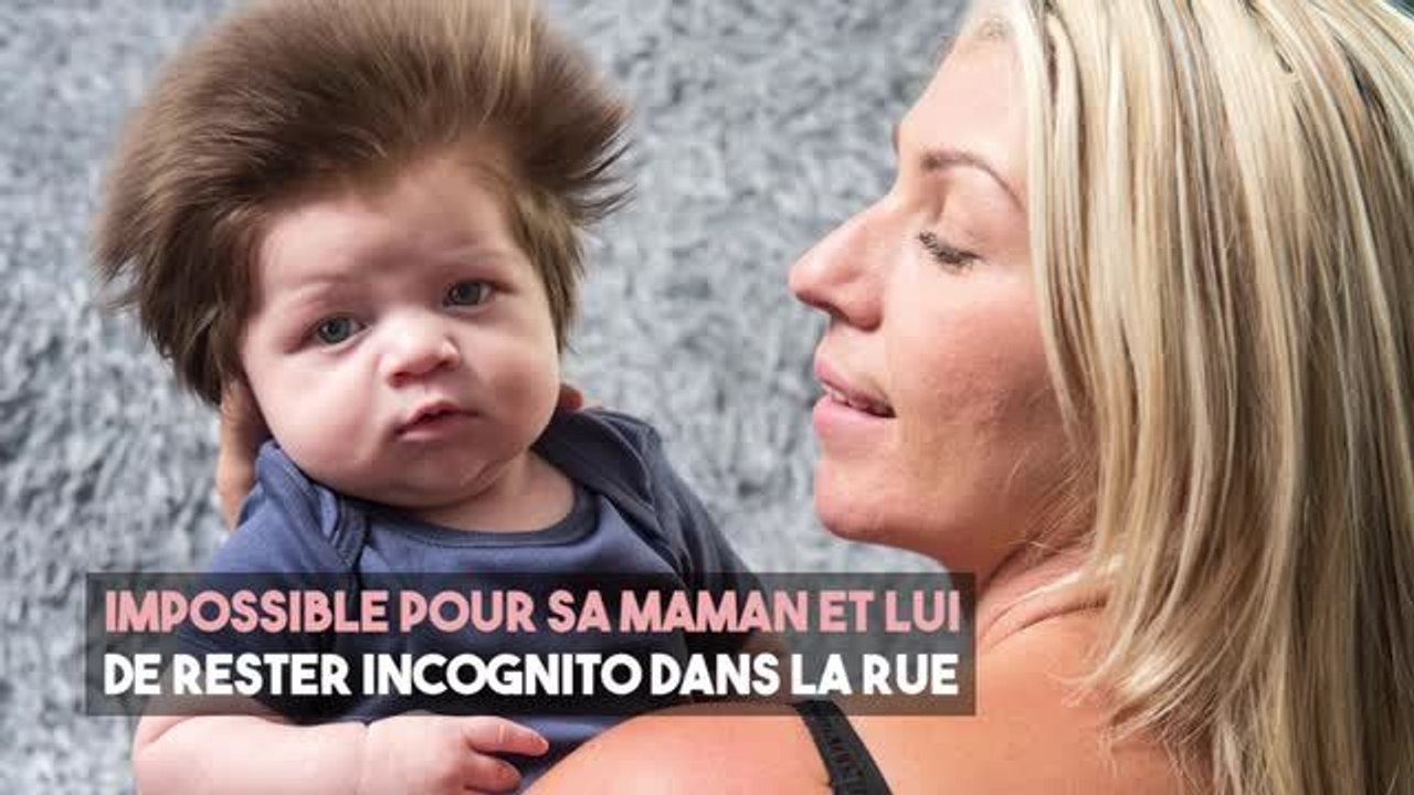 FEMME ACTUELLE - Découvrez l'incroyable chevelure de Junior, le "bébé ourson"