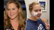 Amy Schumer gets cheek fillers dissolved ‘Turns out I was already full’