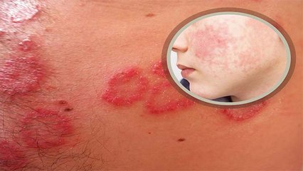 Omicron का ये Symptoms चेहरे पर आता है नजर हो जाएं सावधान | Boldsky