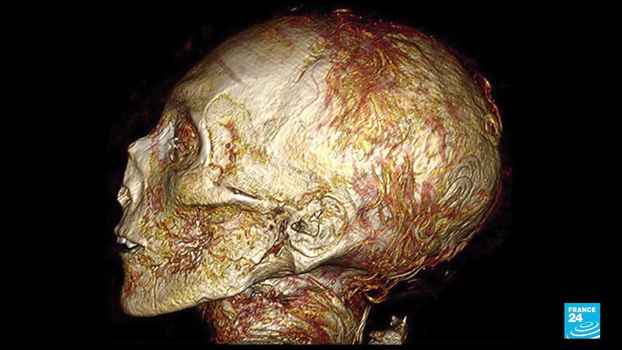 Egypte : les secrets d'une momie royale dévoilés grâce à l'imagerie médicale
