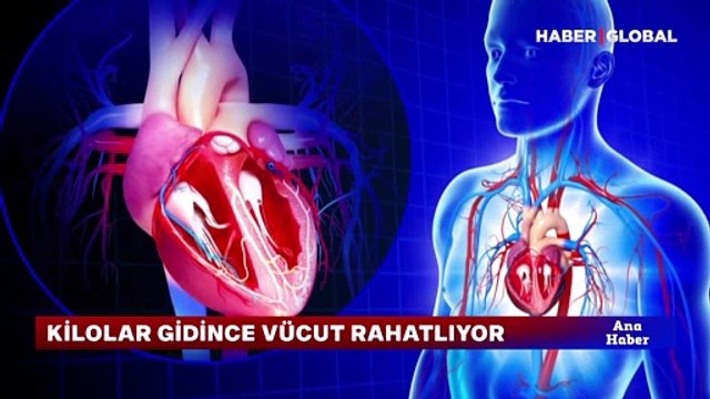 Fazla kilo hastalıkları tetikliyor! Obezite 236 hastalığı etkiler