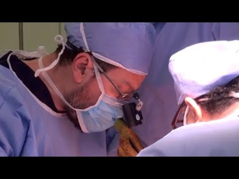 الوطن تعايش زراعة كبد مريض بمستشفى الجهاز الهضمي في المنصورة