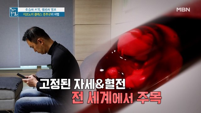 오래 앉아있는 자세가 혈전 부른다? '이코노미 클래스 증후군'