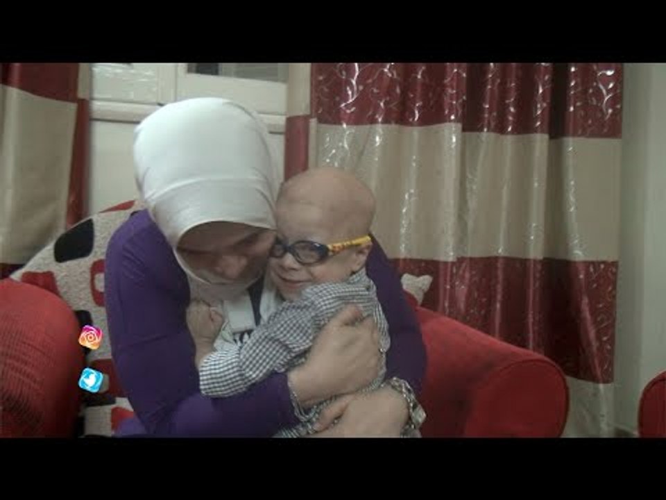 الطفل آدم: صحابي سألوني حالق شعرك ليه؟.. قلت لهم لا ده واقع لوحده