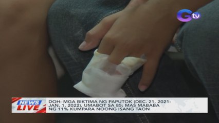 DOH: Mga biktima ng paputok (Dec. 21, 2021-Jan. 1, 2022) umabot sa 85 | News Live