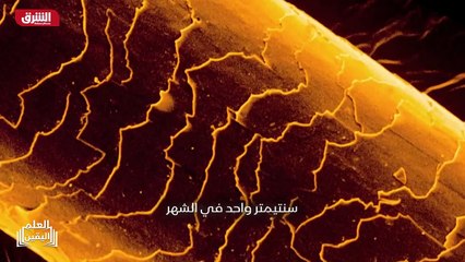 ...دعي الى الحصول على مواد في الشعر فترة طو...