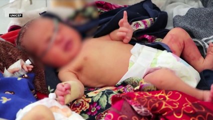 Голод и проблемы с доступом к медицине грозят детям Афганистана