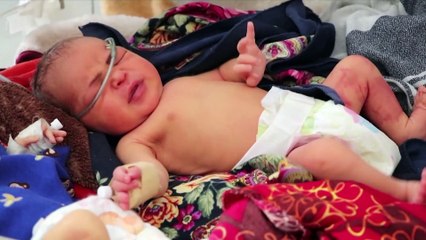 Hunger in Afghanistan - Eltern verkaufen ihre Kinder
