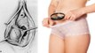 योनि में गांठ Bartholin Cyst का Symptoms, कारण जानना जरूरी Doctors Advice | Boldsky