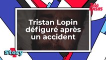 Tristan Lopin défiguré après un accident de vélo, Anne Hidalgo réagit