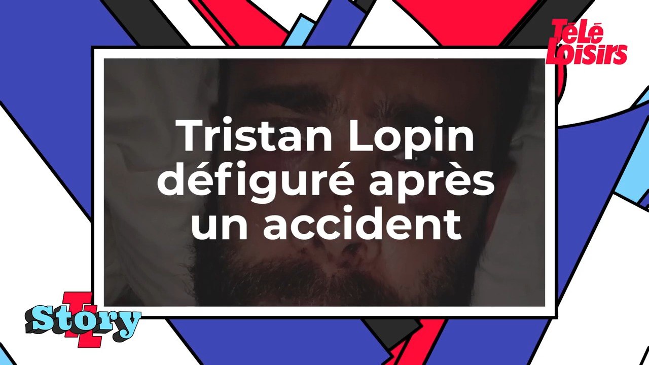 Tristan Lopin défiguré après un accident de vélo, Anne Hidalgo réagit