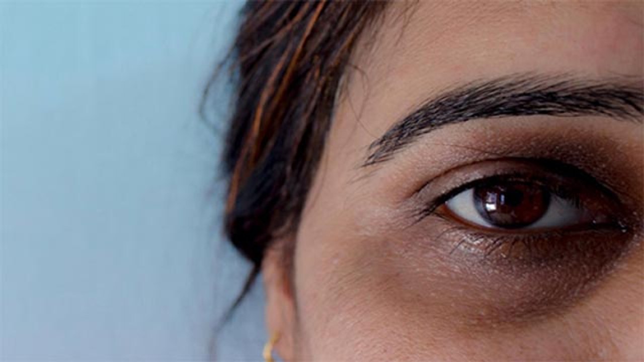 आंखे अंदर धंसने का कारण, कैसे करें बचाव | Boldsky