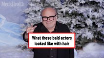 What these bald actors looked like with hair