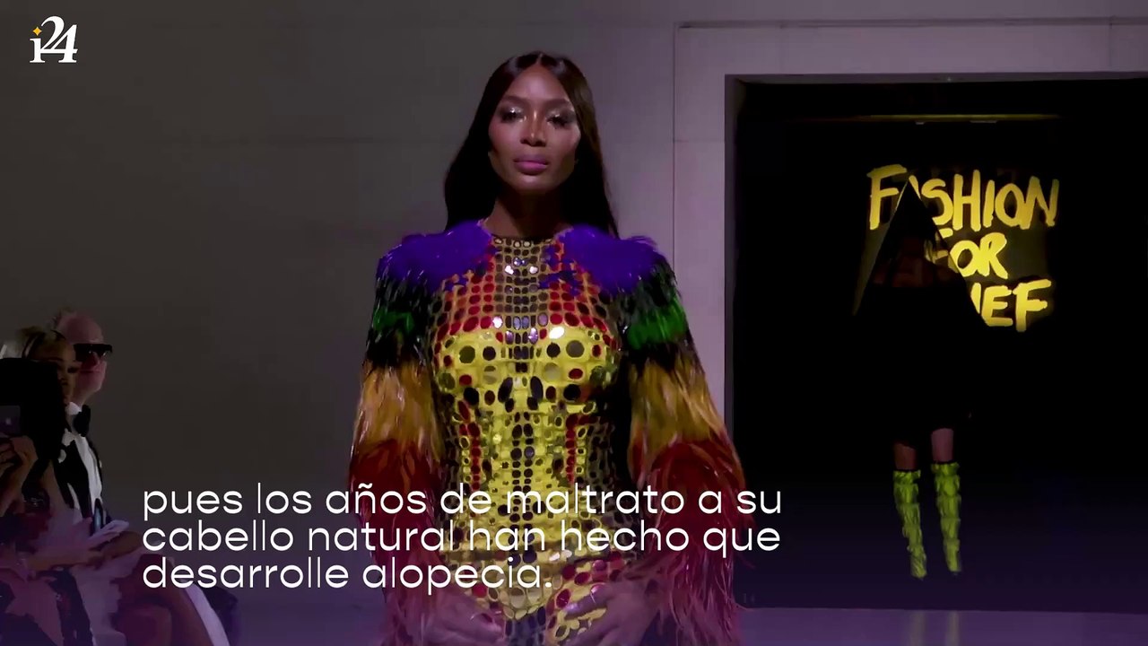 Naomi Campbell usa pelucas porque sufre de alopecia y envía mensaje inspirador