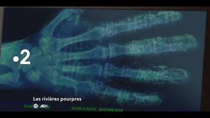 Les rivières pourpres : Leçons de ténèbres (S1EP7-8)