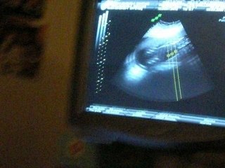 Echo morpho Caroline