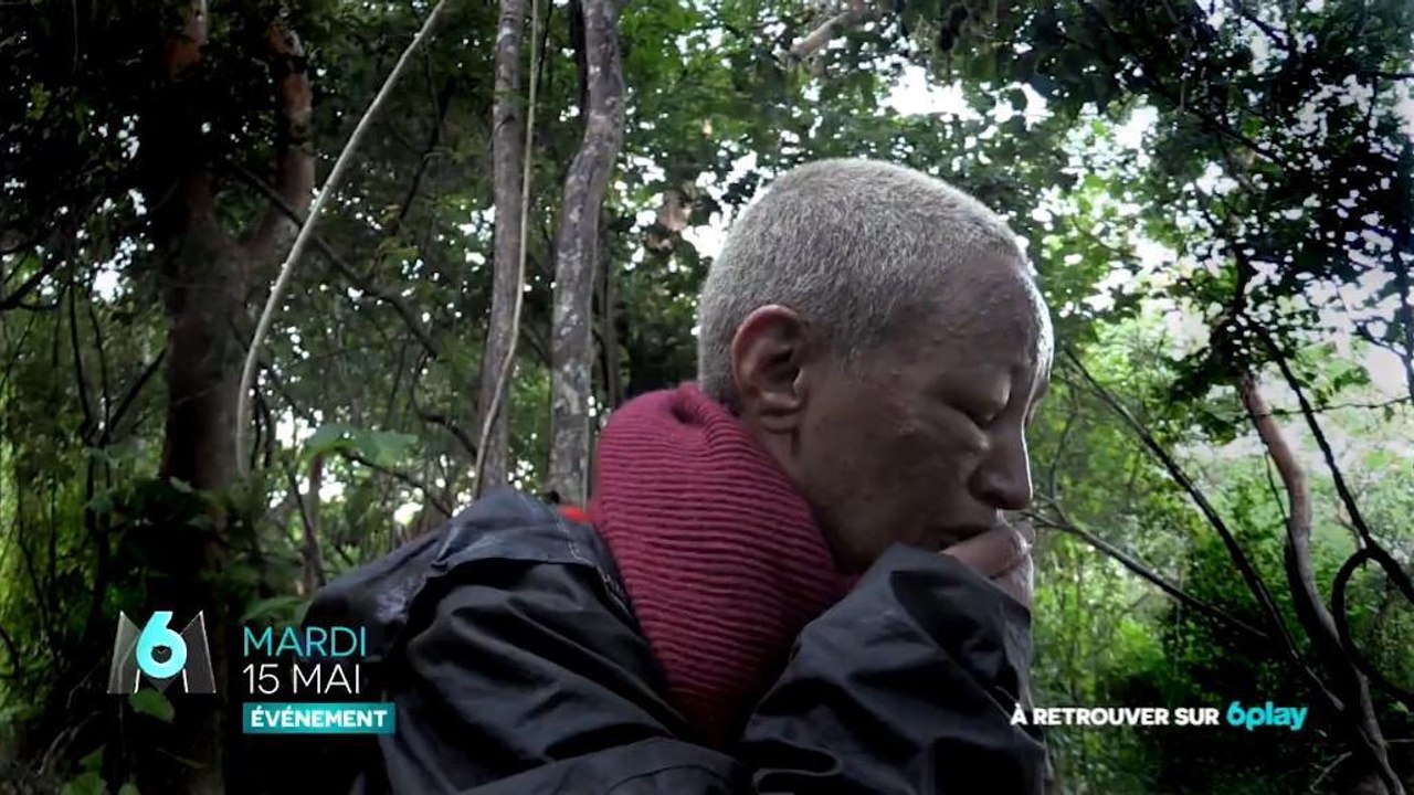 The Island Célébrités : Lââm complètement défigurée !