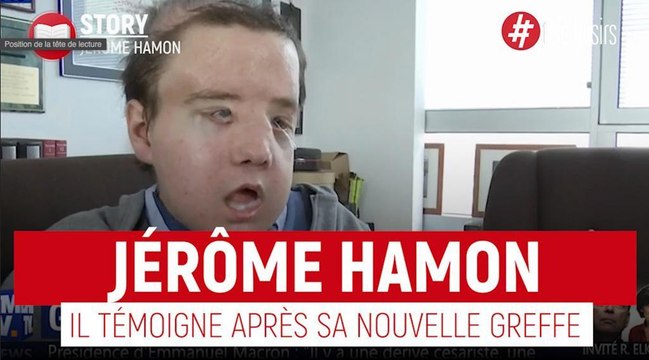 Jérôme Hamon - Il témoigne après sa deuxième greffe du visage