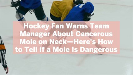 Hockey Fan Warns Team Manager About Cancerous Mole on Neck—Here's How to Tell if a Mole Is