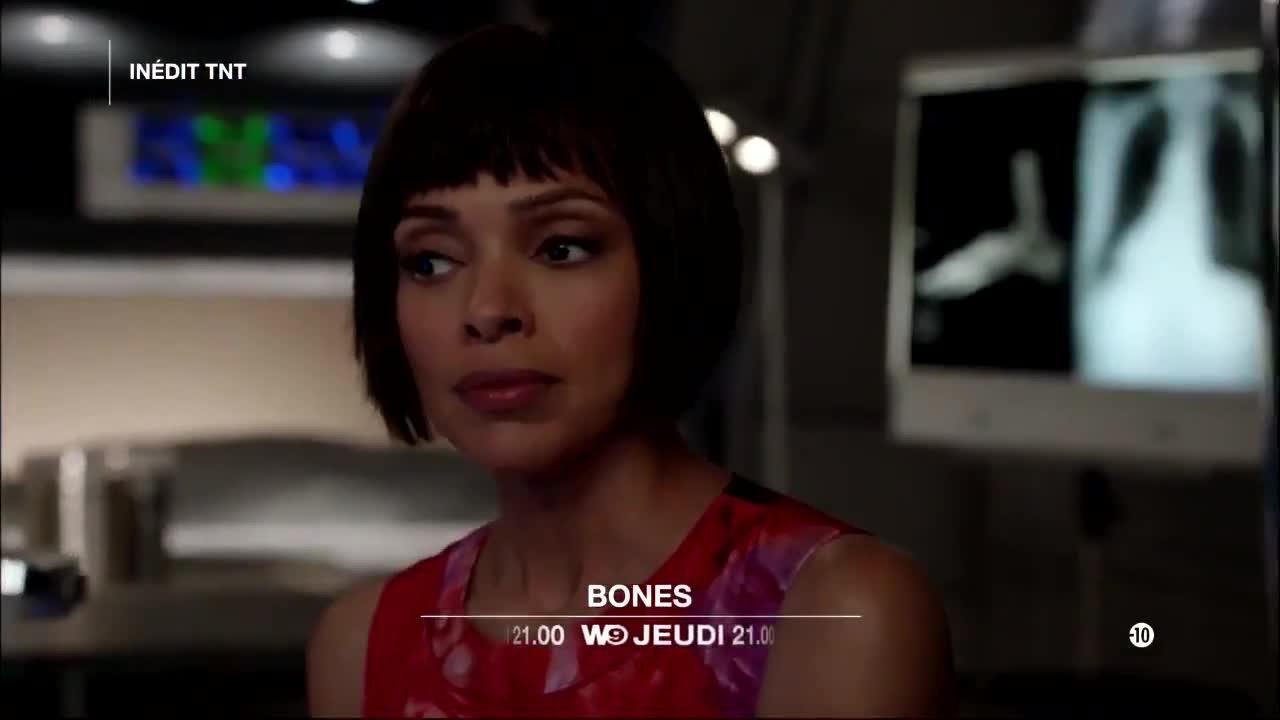 Bones