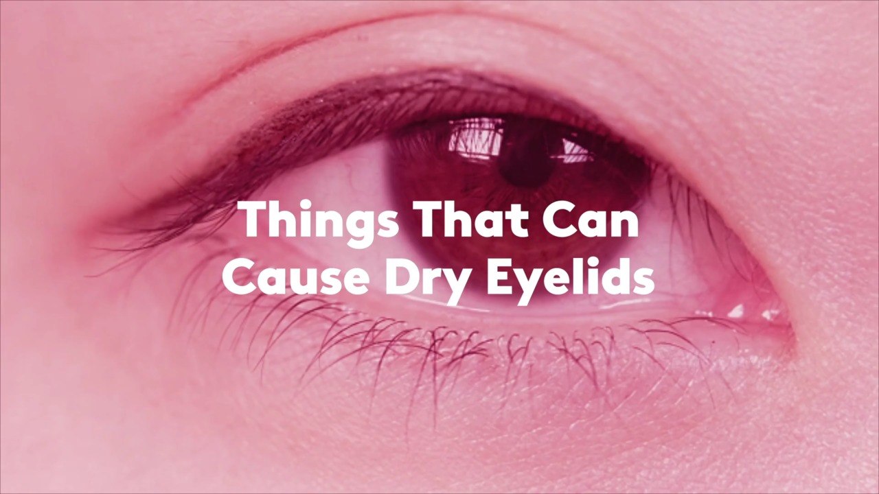 Things That Can Cause Dry Eyelids