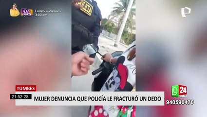 Tumbes: mujer denuncia que policía le rompió el dedo durante intervención