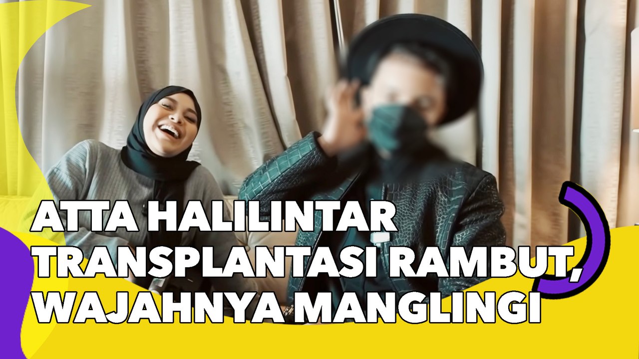 Atta Halilintar Jalani Transplantasi Rambut, Wajahnya Langsung Manglingi