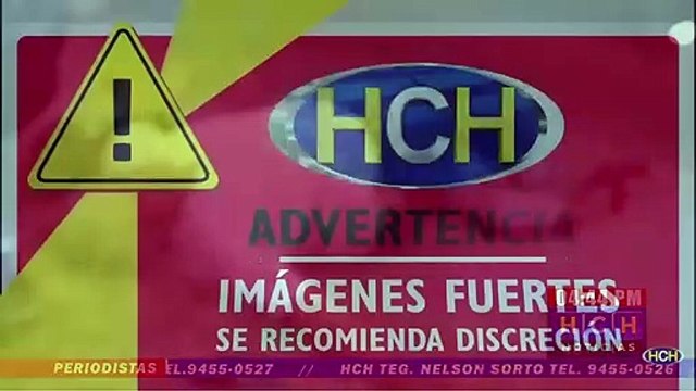 Fuerte accidente vial deja a motociclista con sus dos piernas fracturadas en col. Los Almendros de la capital