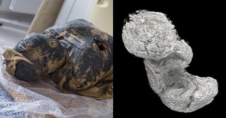 Un fœtus momifié retrouvé dans l'utérus d'une momie, un cas unique au monde