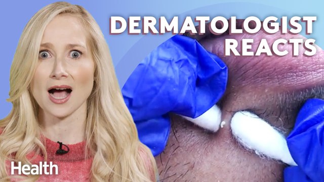 Dermatologist Answers YOUR TikTok Skincare Questions | Ask An Expert | Health