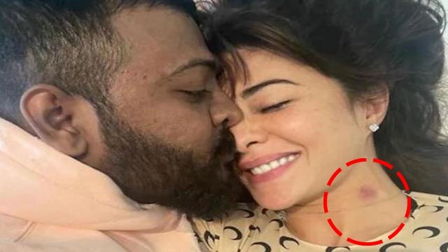 Jacqueline Fernandez Sukesh Chandrashekhar के Private Moments Picture Viral | Boldsky