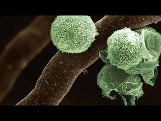 الفطر الأخضر.. عدوى جديدة تهاجم متعافي كورونا: موجود في كل مكان