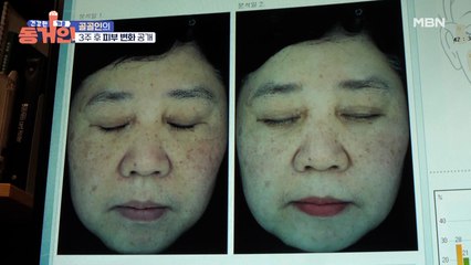 우리 골골인이 달라졌어요...! 골골인의 3주 후 피부 변화 대 공개!