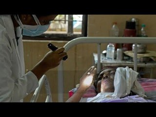 أشرس من الأسود.. أستاذ بيولوجي بالهند يتحدث عن خطورة الفطر الأبيض